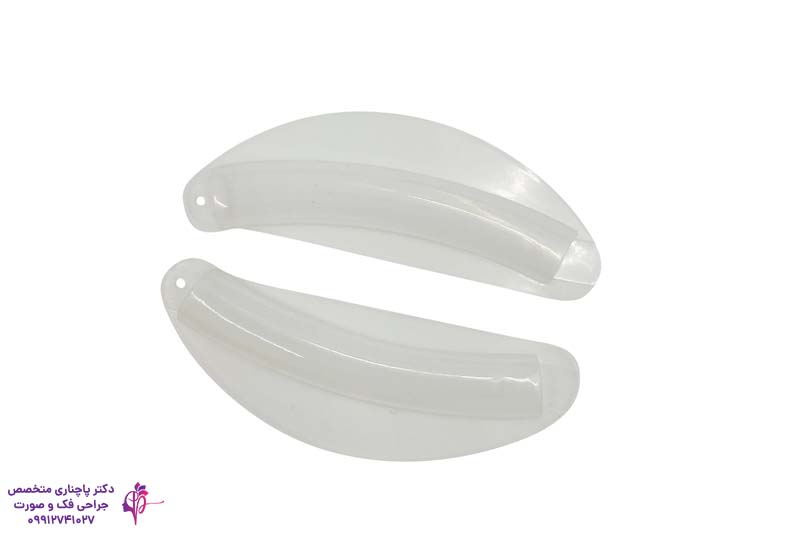 اسپلینت بینی