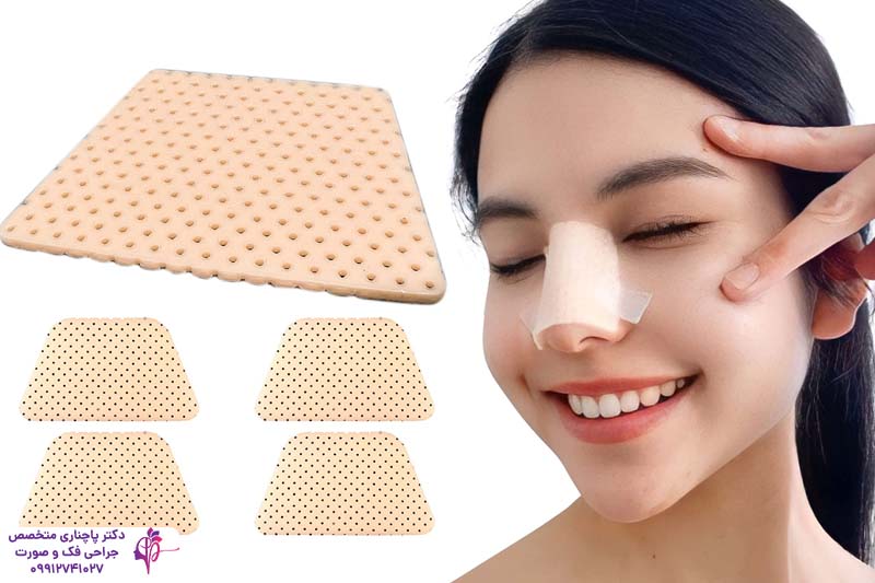 اسپلینت بینی