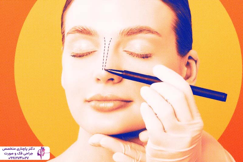 انواع جراحی زیبایی بینی