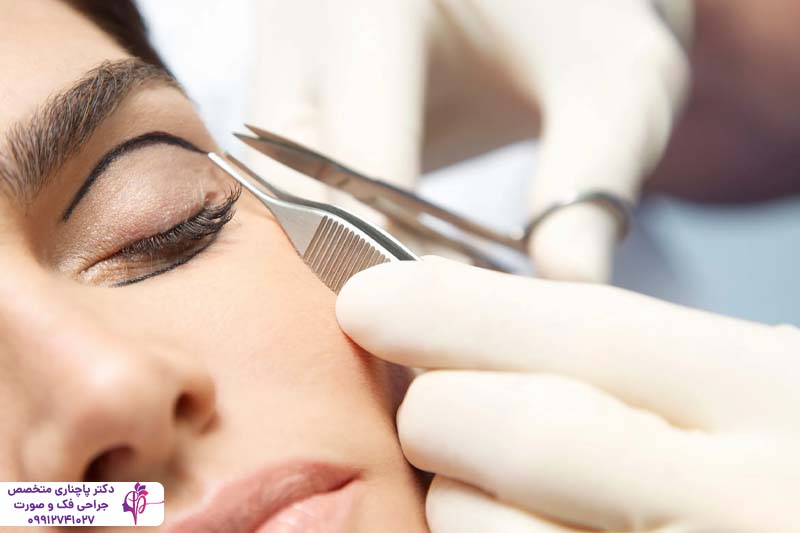 کرم ترمیم کننده بلفاروپلاستی