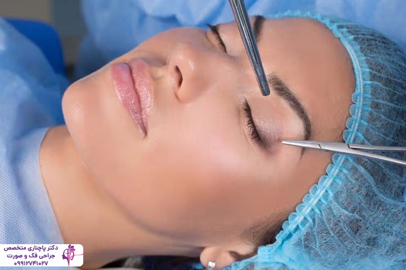 کرم ترمیم کننده بلفاروپلاستی